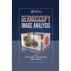 Dermoscopy Image Analysis