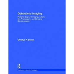 Ophthalmic Imaging: Posterior Segment Imaging, Anterior Eye Photography, and Slit Lamp Biomicrography