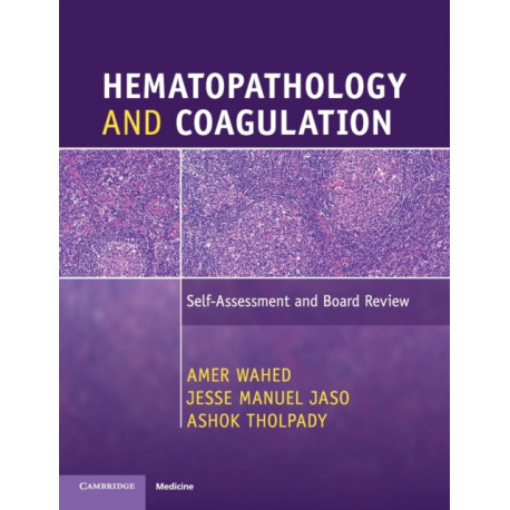 Hematopathology and Coagulation: Self-Assessment and Board Review