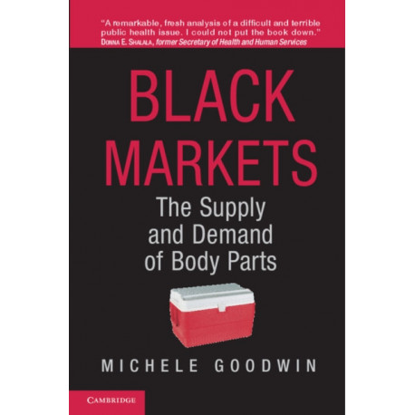 Black Markets: The Supply and Demand of Body Parts