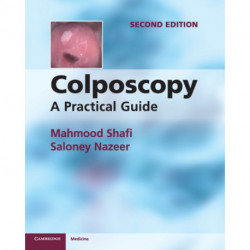 Colposcopy: A Practical Guide