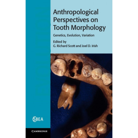 Anthropological Perspectives on Tooth Morphology: Genetics, Evolution, Variation