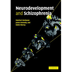 Neurodevelopment and Schizophrenia