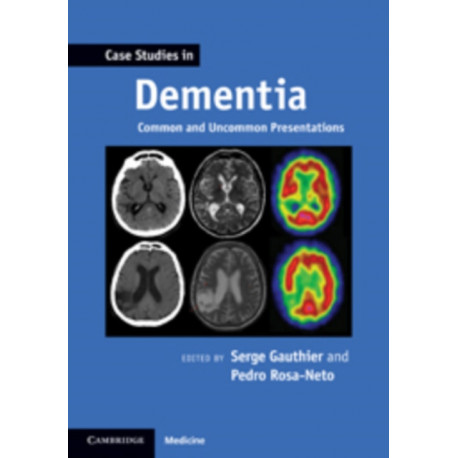 Case Studies in Dementia: Volume 1: Common and Uncommon Presentations