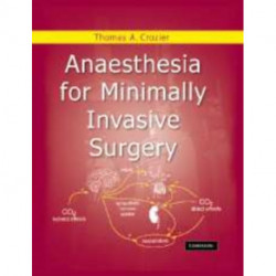 Anaesthesia for Minimally Invasive Surgery