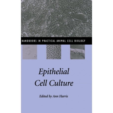 Epithelial Cell Culture