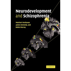 Neurodevelopment and Schizophrenia