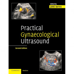 Practical Gynaecological Ultrasound