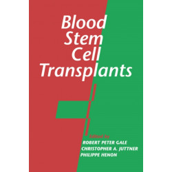 Blood Stem Cell Transplants