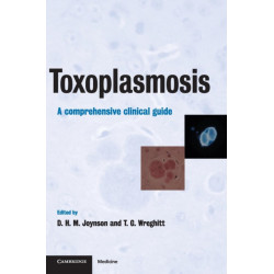 Toxoplasmosis: A Comprehensive Clinical Guide