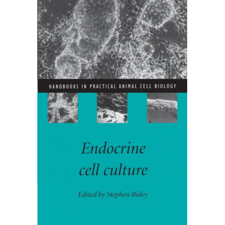 Endocrine Cell Culture
