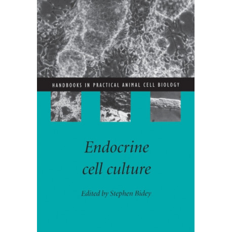 Endocrine Cell Culture