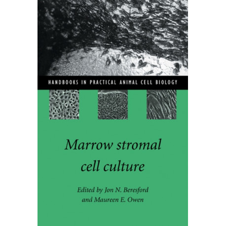 Marrow Stromal Cell Culture