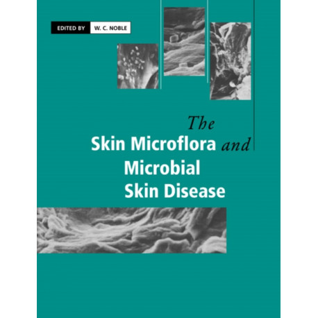 The Skin Microflora and Microbial Skin Disease