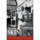 Acres of Skin: Human Experiments at Holmesburg Prison
