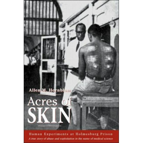 Acres of Skin: Human Experiments at Holmesburg Prison