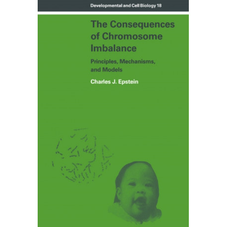 The Consequences of Chromosome Imbalance: Principles, Mechanisms, and Models
