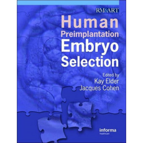 Human Preimplantation Embryo Selection