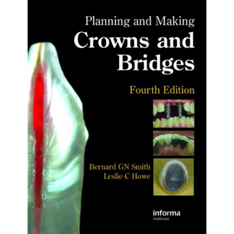 Planning and Making Crowns and Bridges