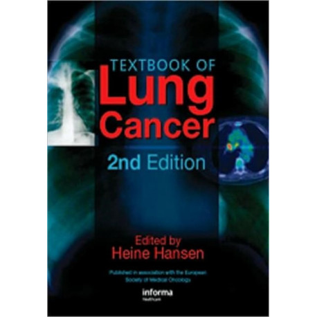 Textbook of Lung Cancer