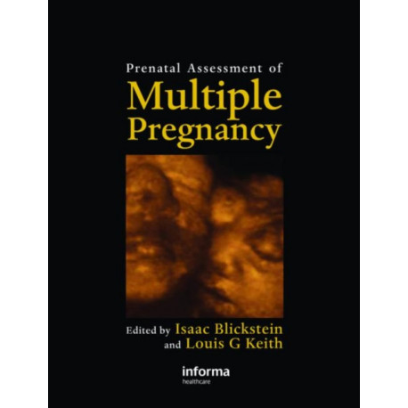 Prenatal Assessment of Multiple Pregnancy
