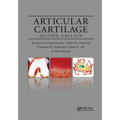 Articular Cartilage