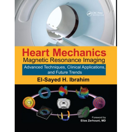Heart Mechanics: Magnetic Resonance Imaging—Advanced Techniques, Clinical Applications, and Future Trends