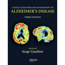 Clinical Diagnosis and Management of Alzheimer's Disease