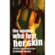The Woman Who Lost Her Skin: (And Other Dermatological Tales)