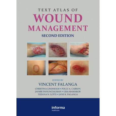Text Atlas of Wound Management