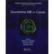 Quantitative MRI in Cancer