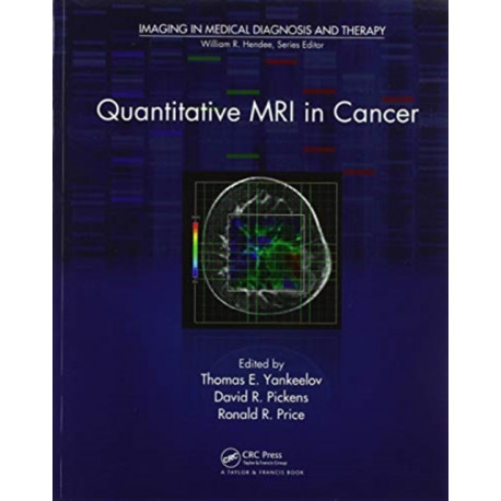Quantitative MRI in Cancer