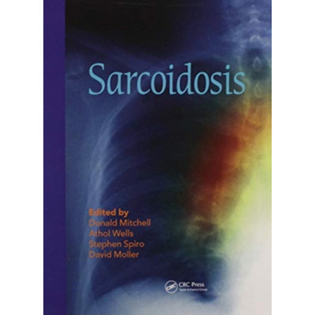 Sarcoidosis