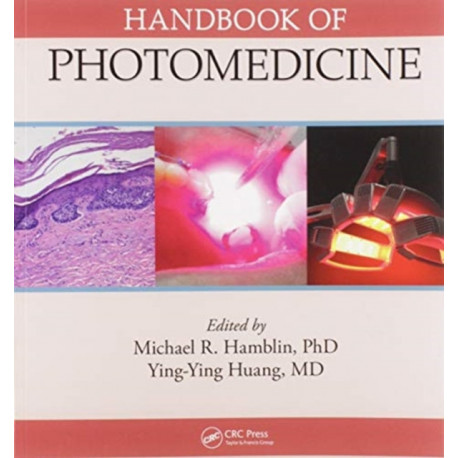 Handbook of Photomedicine