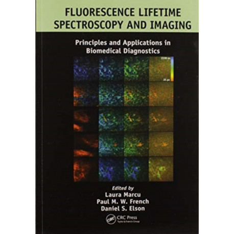 Fluorescence Lifetime Spectroscopy and Imaging: Principles and Applications in Biomedical Diagnostics