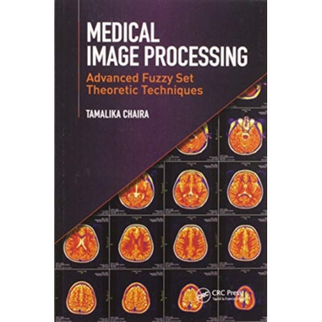 Medical Image Processing: Advanced Fuzzy Set Theoretic Techniques