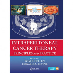 Intraperitoneal Cancer Therapy: Principles and Practice