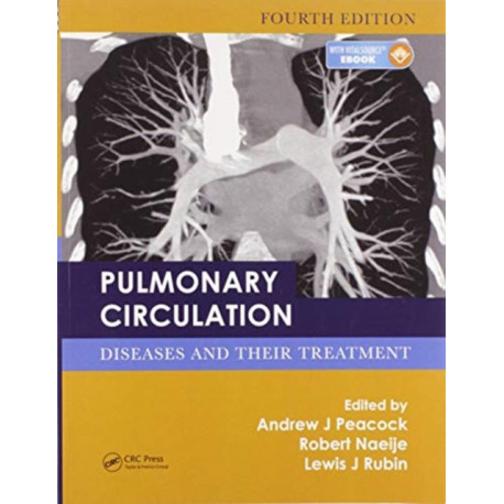 Pulmonary Circulation: Diseases and Their Treatment, Fourth Edition