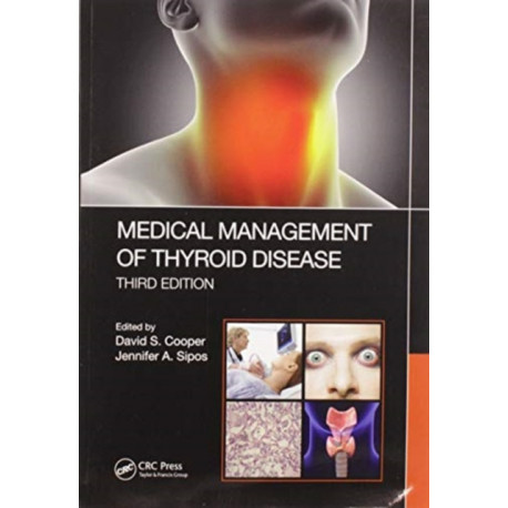 Medical Management of Thyroid Disease, Third Edition