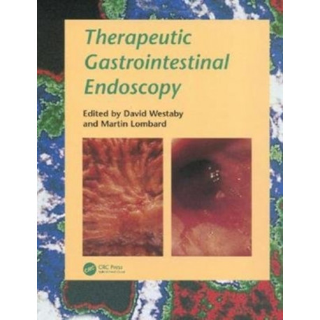 Therapeutic Gastrointestinal Endoscopy