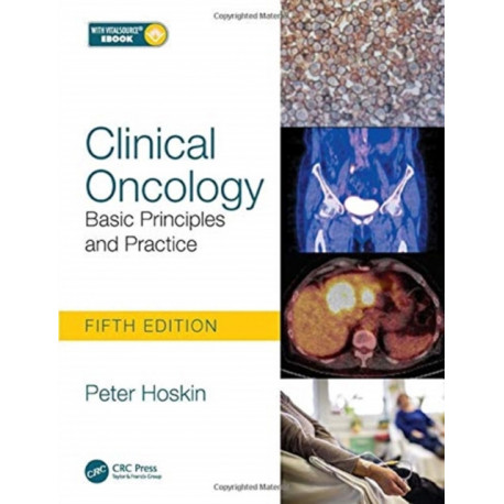 Clinical Oncology: Basic Principles and Practice