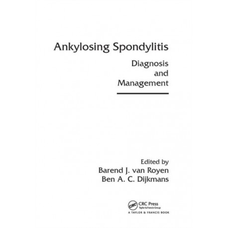 Ankylosing Spondylitis: Diagnosis and Management