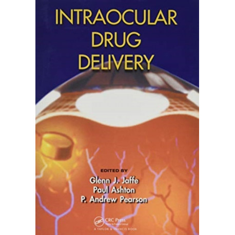 Intraocular Drug Delivery