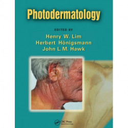 Photodermatology