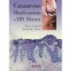 Cutaneous Manifestations of HIV Disease
