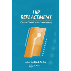 Hip Replacement: Current Trends and Controversies