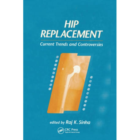 Hip Replacement: Current Trends and Controversies