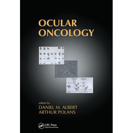 Ocular Oncology