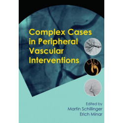 Complex Cases in Peripheral Vascular Interventions