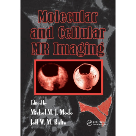 Molecular and Cellular MR Imaging